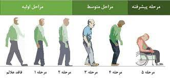 پاورپوینت بیماری پارکینسون و آشنایی باتکنیک های توانبخشی ورزشی این بیماران