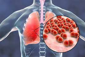 پاورپوینت اپیدمیولوژی COPD