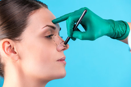 پاورپوینت درباره RHINOPLASTY رینو پلاستی