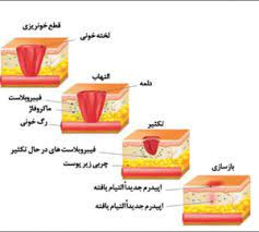 پاورپوینت فرایند ترمیم زخم