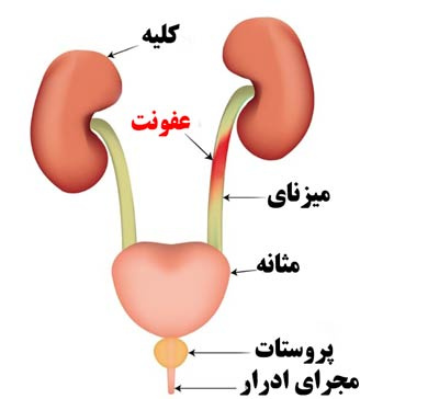 پاورپوینت آناتومی کلیه ها و مجاری ادراری