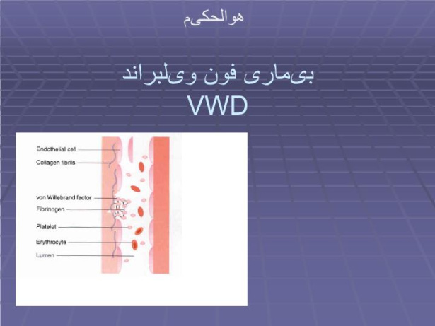 پاورپوینت بیماری فون ویلبراندVWD