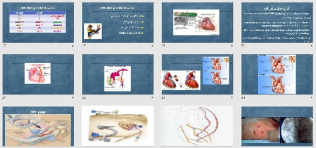پاورپوينت با عنوان جراحی قلب و مراقبت پرستاری در آن