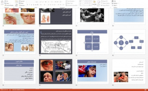 دانلود فایل پاورپوینت آموزشی و قابل ویرایش آسیب های سر وبیهوشی