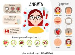 پاورپوینت Anemia آنیما