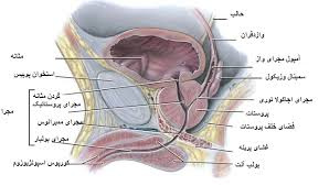 دانلود پاورپوینت هیپر پلازی خوش خیم پروستات (BPH)