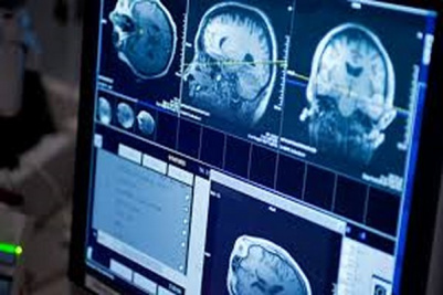 پاورپوینت ارزیابی خون ریزی های مغزی در MRI