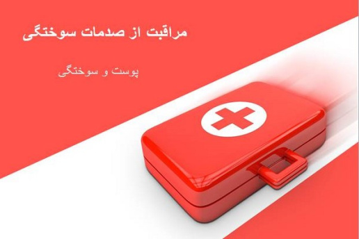 پاورپوینت مراقبت از صدمات سوختگی