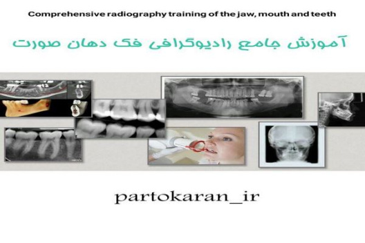 آموزش جامع انواع رادیوگرافی در فک دهان صورت