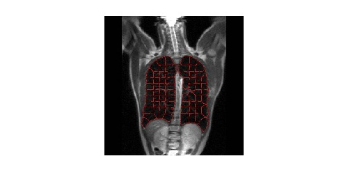 شبیه سازی در زمینه ادغام تصویر MRI با استفاده از تشخیص الگو مارها