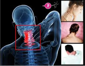 پاورپوینت “ آسیب و اختلال سر و گردن ( head and neck trauma )