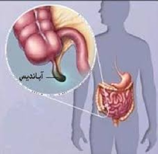 مقاله ای کامل در مورد بیماری آپاندیس