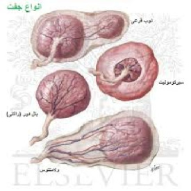 پاورپوینت اختلالات جفت و پرده ها