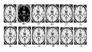 ترجمه مقاله تحلیل کارایی روش دسته بندی فازی C-Means برای قطعه بندی عکسهای MRI