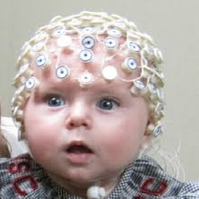 داده EEG آماده افراد مبتلا به تشنج