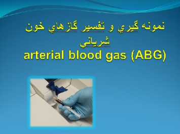 نمونه گيري و تفسير گازهاي خون شرياني ABG