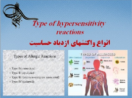 انواع واکنشهای ازدیاد حساسیت  ( انواع آلرژیها ) Type of hypersensitivity reactions