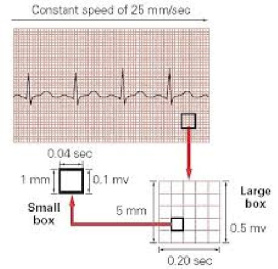 جزوه تفسیر ECG