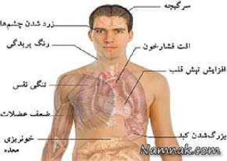 سیستم خبره تشخیص و درمان کم خونی