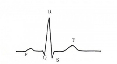 دانلود پروژه تشخیص نقاط مشخصه سیگنال ECG ، نوشته شده با زبان متلب، PQRST