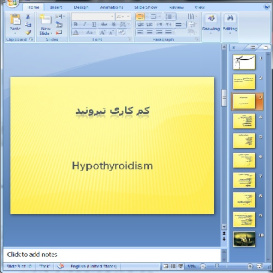 دانلود پاورپوینت کم کاری تيروئيد - 10 اسلاید