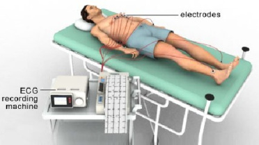 تحقیق دستگاه الکتروکاردیوگراف